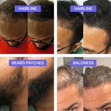 Blinqo Hair Filler Powder: Instant Volume, Thicker Hair, Natural Look