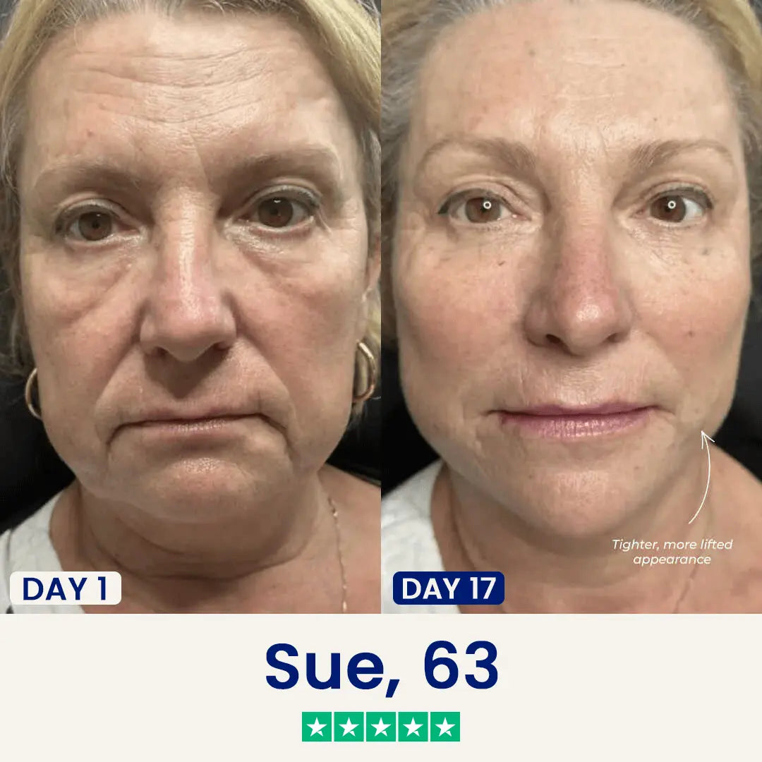 Blinqo Chinology Sculpt V-Lift Mask